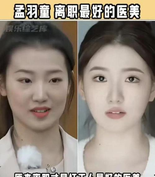 整容视频,从素颜到网红脸的华丽蜕变